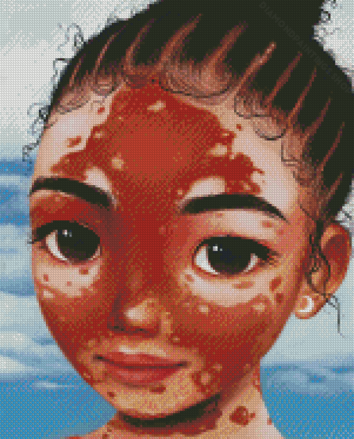 Vitiligo Girl Art diamond painting